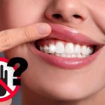 Denti e gengive sane: elimina subito questa abitudine