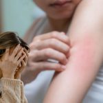 i disturbi psicosomatici cutanei più diffusi