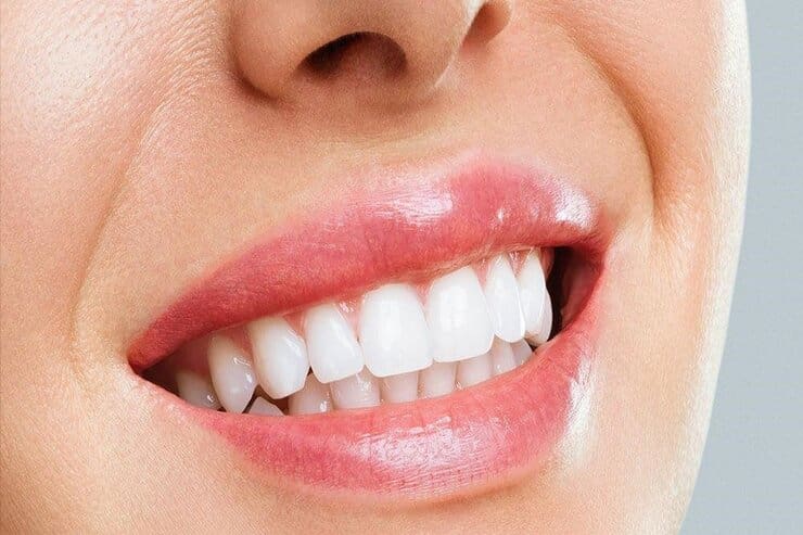 evitando alcuni orrori i denti saranno perfetti