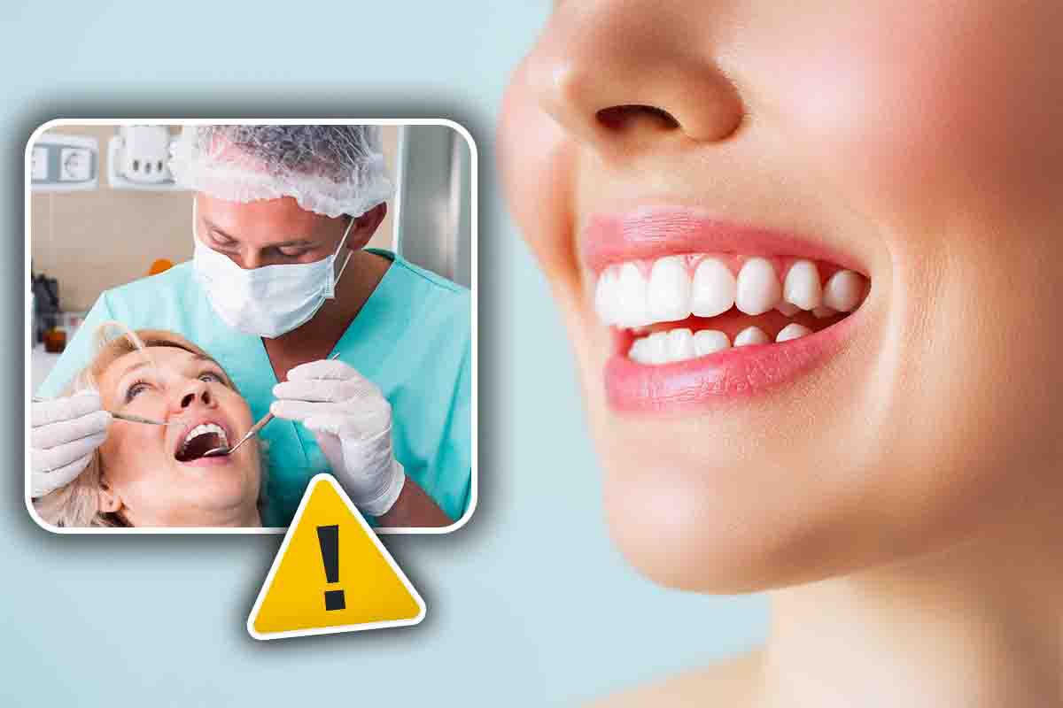 Stai distruggendo i denti con i tuoi errori