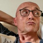 Le cause delle cicatrici sulla testa di Signorini